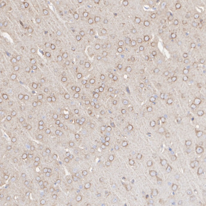 LRP1 Rabbit Monoclonal Antibody(ARA839)