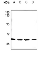 CDYL2 Rabbit Polyclonal Antibody