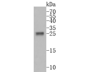 PRSS2 Rabbit Polyclonal Antibody