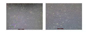 Exosome-specific MSC Medium