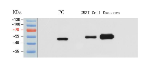 Exosome TSG101 Protein Detection Kit