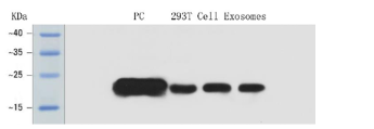 Exosome CD81 Protein Detection Kit
