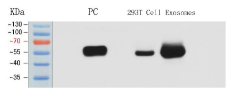 Exosome CD63 Protein Detection Kit