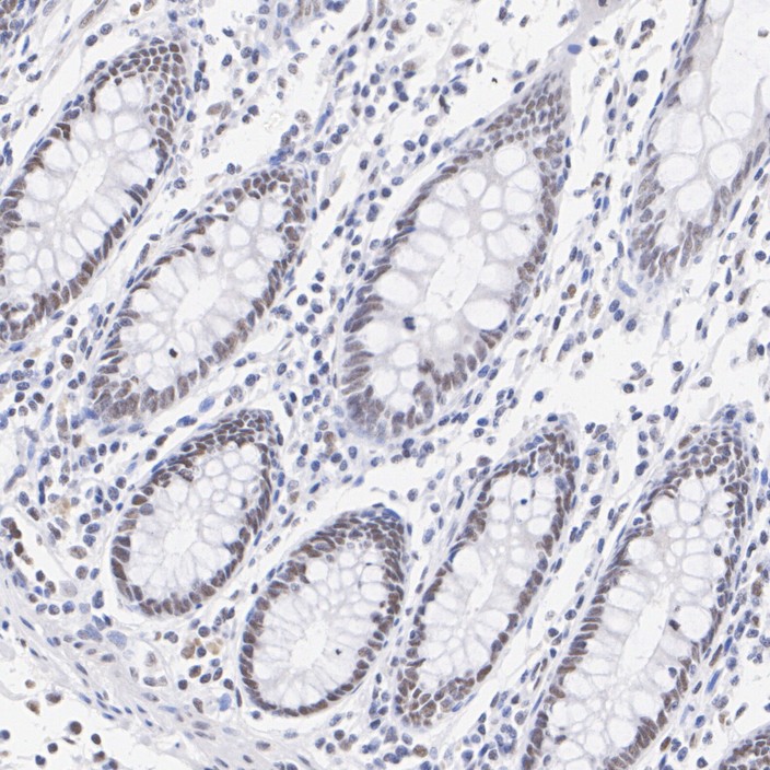 MLH1 Rabbit Monoclonal Antibody(ARA726)
