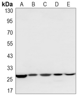 Prohibitin Rabbit Monoclonal Antibody(ARA999)