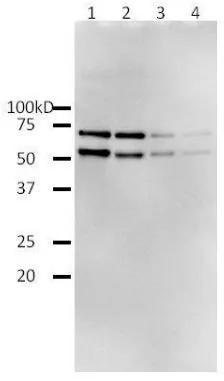 HIV1 Reverse transcriptase Rabbit Polyclonal Antibody