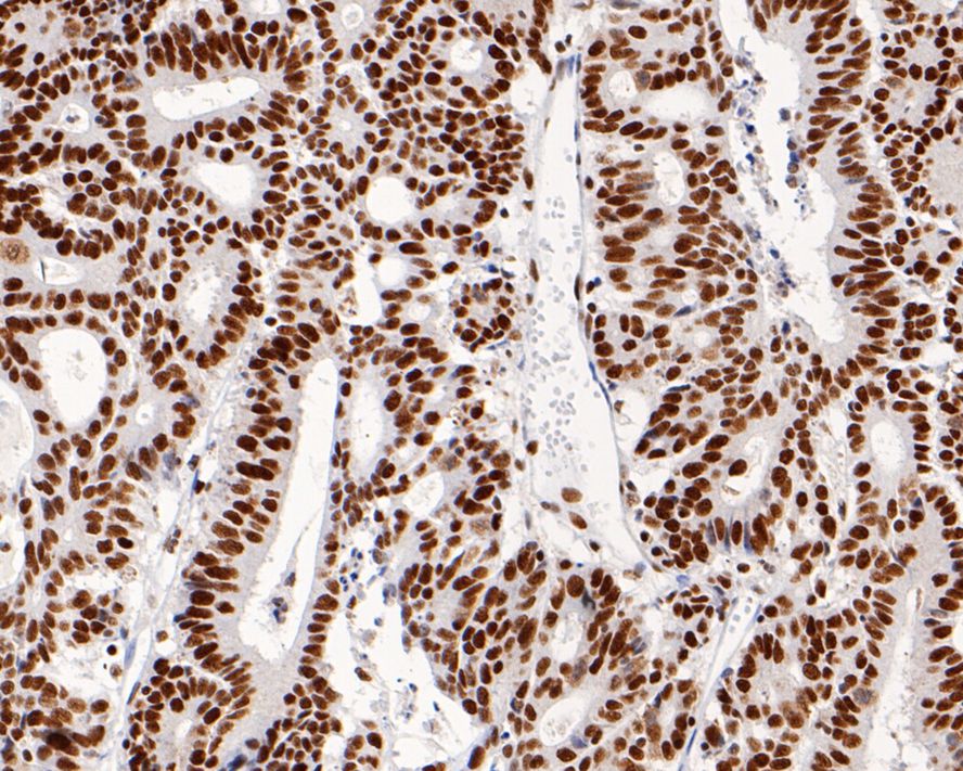 MSH2 Mouse Monoclonal Antibody(ARA725)