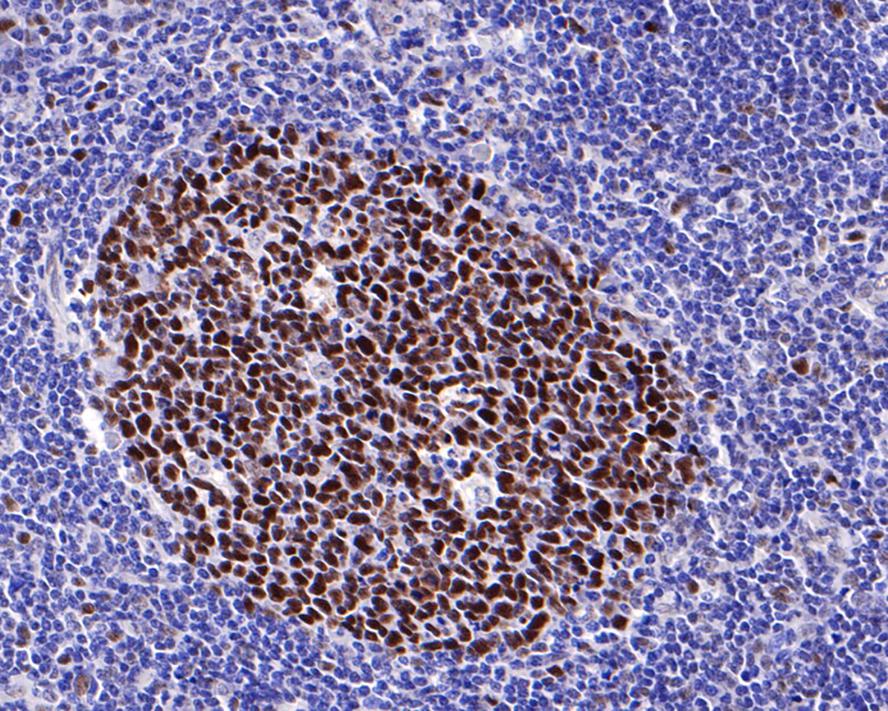 MSH6 Rabbit Monoclonal Antibody(ARA724)