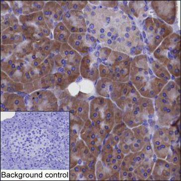 IFI27 Mouse Monoclonal Antibody(ARA720)