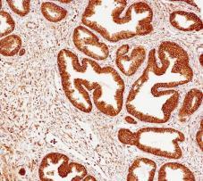 Calreticulin Rabbit Monoclonal Antibody(ARB888)