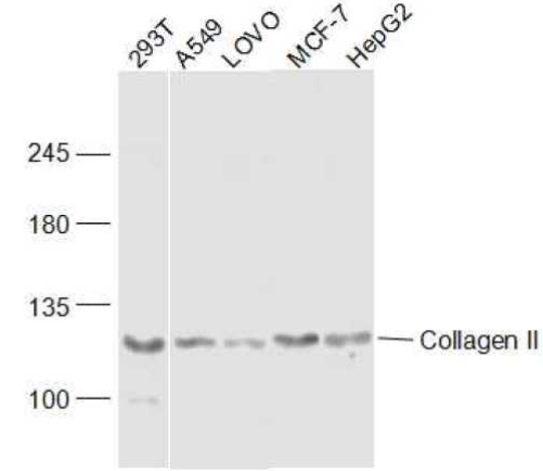 Collagen II Rabbit Polyclonal Antibody