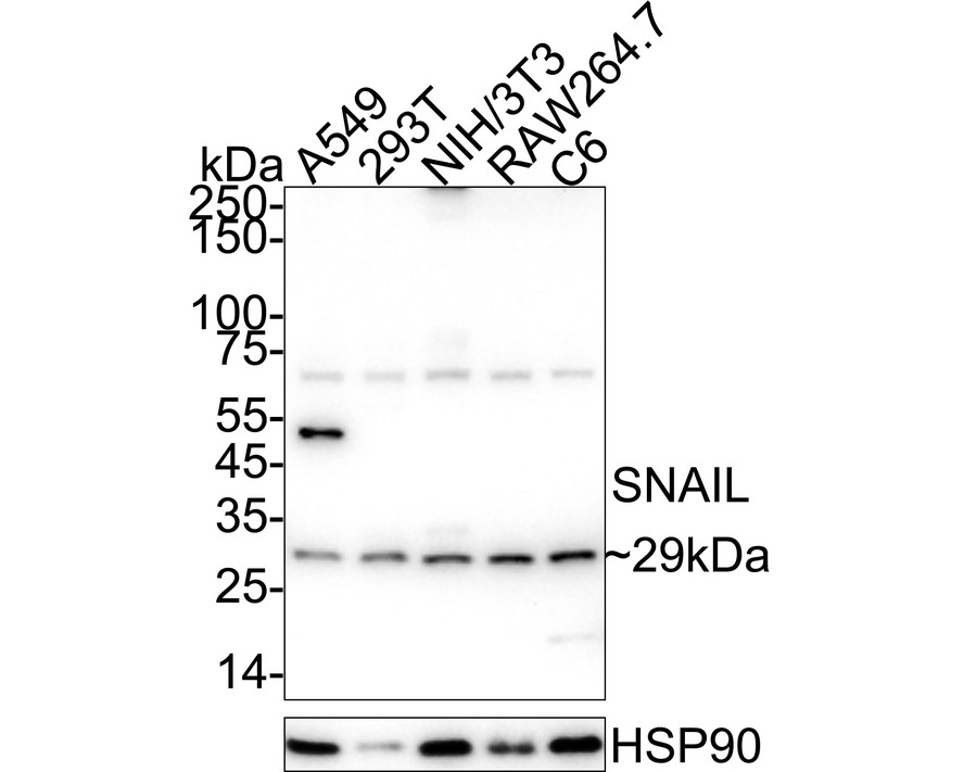 SNAIL Rabbit Polyclonal Antibody