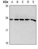 Glucagon Rabbit Polyclonal Antibody