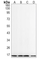 Beta 2 Microglobulin Rabbit Monoclonal Antibody(ARA689)