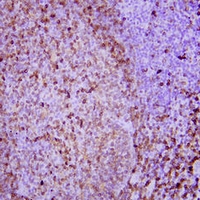 CD74 Mouse Monoclonal Antibody(ARA685)
