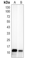 MIF Rabbit Monoclonal Antibody(ARA688)