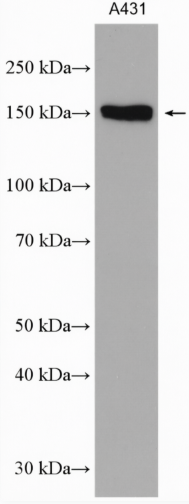 PHLDB2 Rabbit Polyclonal Antibody