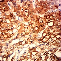 MAGEA4 Mouse Monoclonal Antibody(C2824)