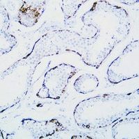 MAGEC1 Mouse Monoclonal Antibody(C2363)