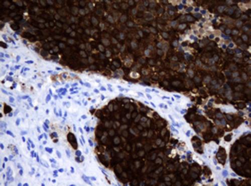 MAGEA3 Mouse Monoclonal Antibody(ARA684)