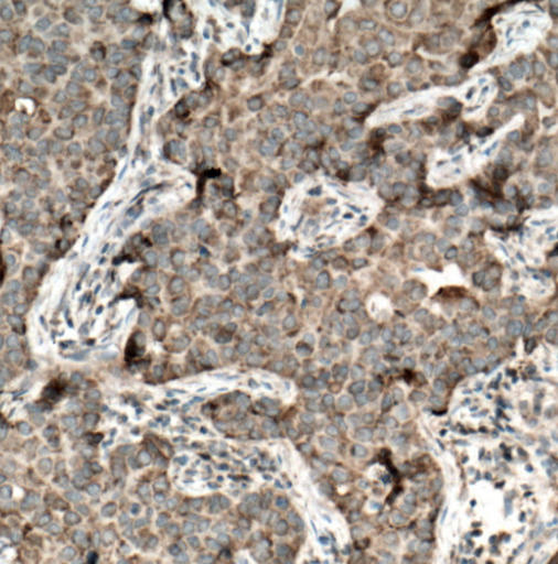 KK-LC-1 Rabbit Polyclonal Antibody