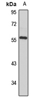 Cytochrome P450 4B1 Rabbit Polyclonal Antibody