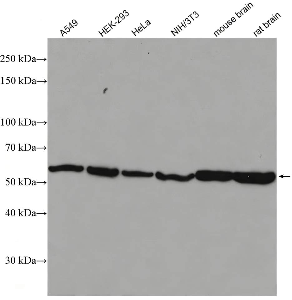 Alpha Tubulin Rabbit Polyclonal antibody