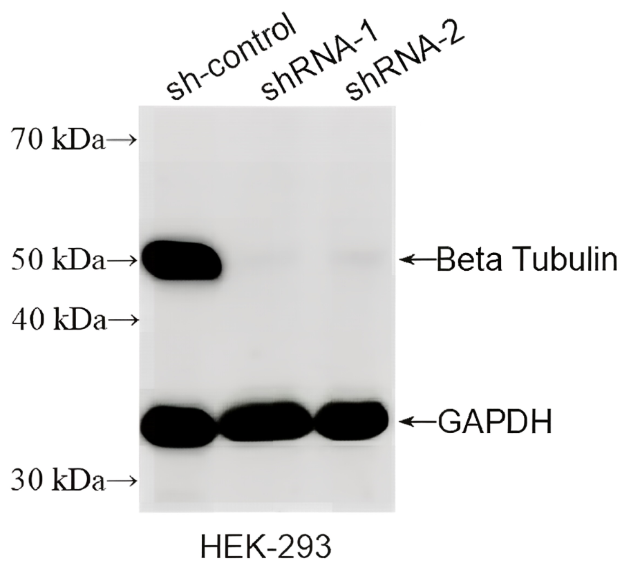 Beta Tubulin Rabbit monoclonal antibody(ARA675)
