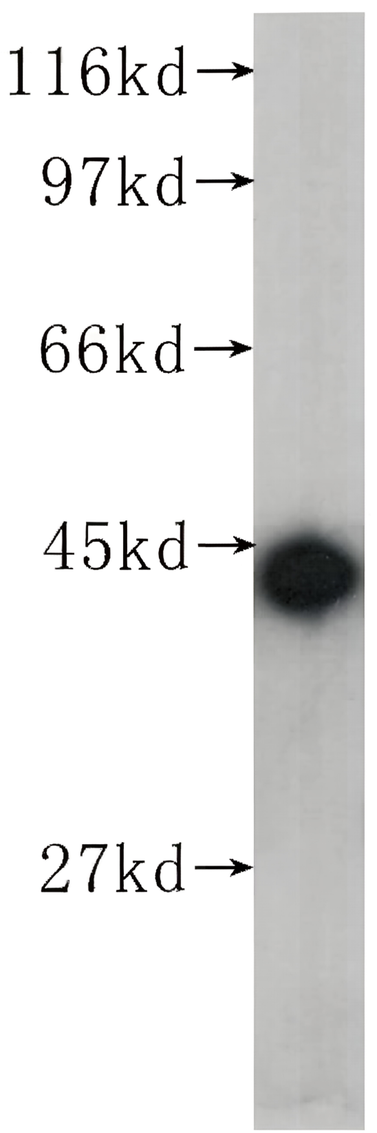 Beta Actin Mouse Monoclonal antibody(ARA711)