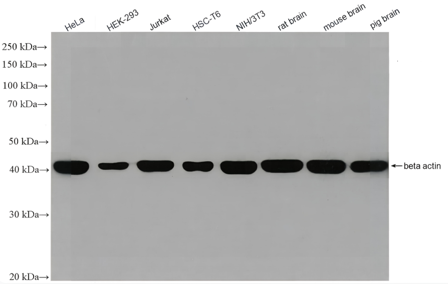 Beta Actin Rabbit Monoclonal antibody(ARA710)