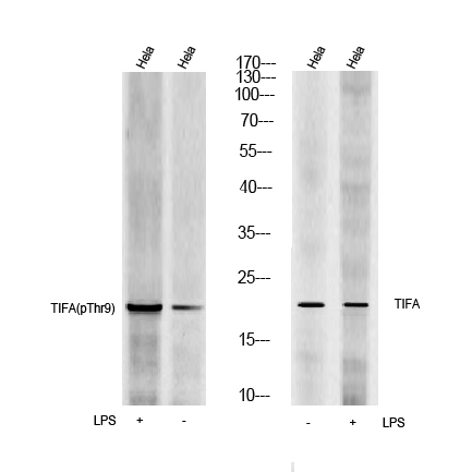 TIFA(Phospho Thr9) Rabbit Polyclonal Antibody