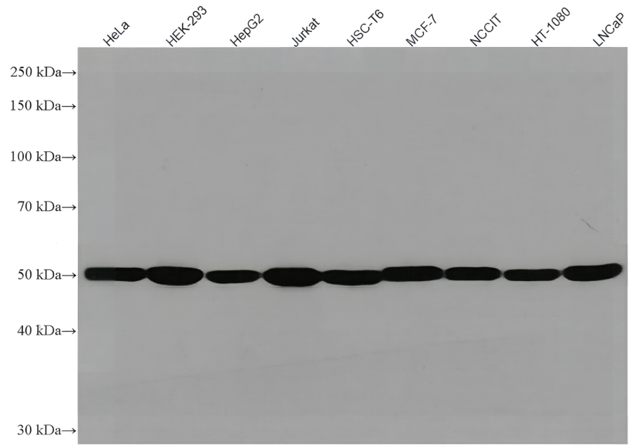 Beta Tubulin Mouse Monoclonal antibody(ARA709)