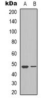 VEGFC Rabbit Polyclonal Antibody