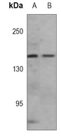 VEGFR3 Mouse Monoclonal Antibody(C3773)