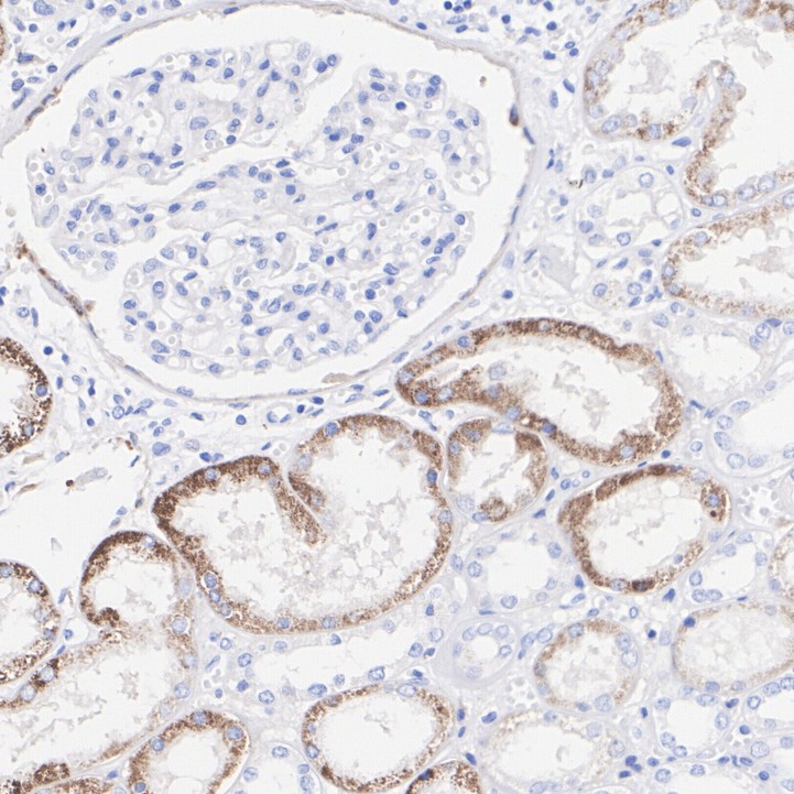 CXCL12/SDF1 Rabbit Monoclonal Antibody(ARA682)