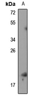 RPS19BP1 Rabbit Polyclonal Antibody