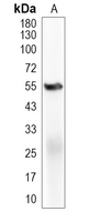 GPER Rabbit Monoclonal Antibody(C4063)