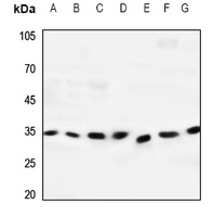 Dectin 2 Rabbit Polyclonal Antibody