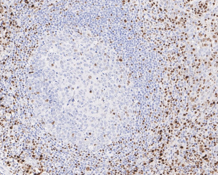 RUNX2 Rabbit Monoclonal Antibody(ARA674)