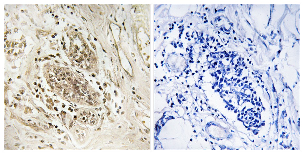 POLE Rabbit Polyclonal Antibody