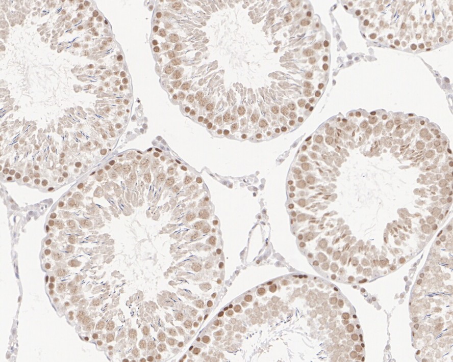 POLD1 Rabbit Monoclonal Antibody(ARA680)