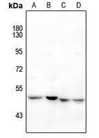 RAR beta Rabbit Polyclonal Antibody