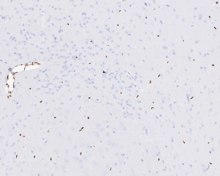 FOXC1 Rabbit Monoclonal Antibody(ARA672)