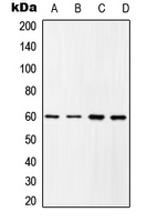 c-SRC (Phospho-Y419) Rabbit Polyclonal Antibody