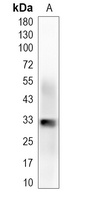 NUS1 Rabbit Monoclonal Antibody(C2009)