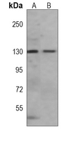 SIRT1 Mouse Monoclonal Antibody(C3969)