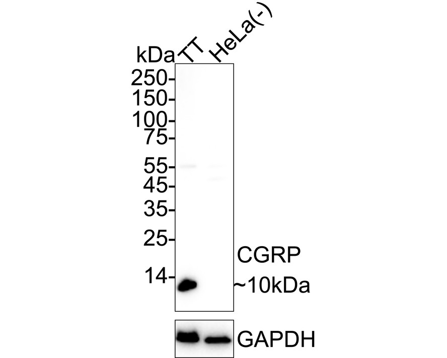CGRP Rabbit Monoclonal Antibody(ARA667)