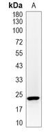 KRAS Rabbit Monoclonal Antibody(ARA666)