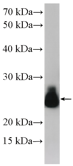 RAB11B-Specific Rabbit Polyclonal Antibody