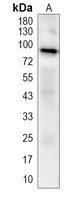 CPT1A Rabbit Monoclonal Antibody(C4067)